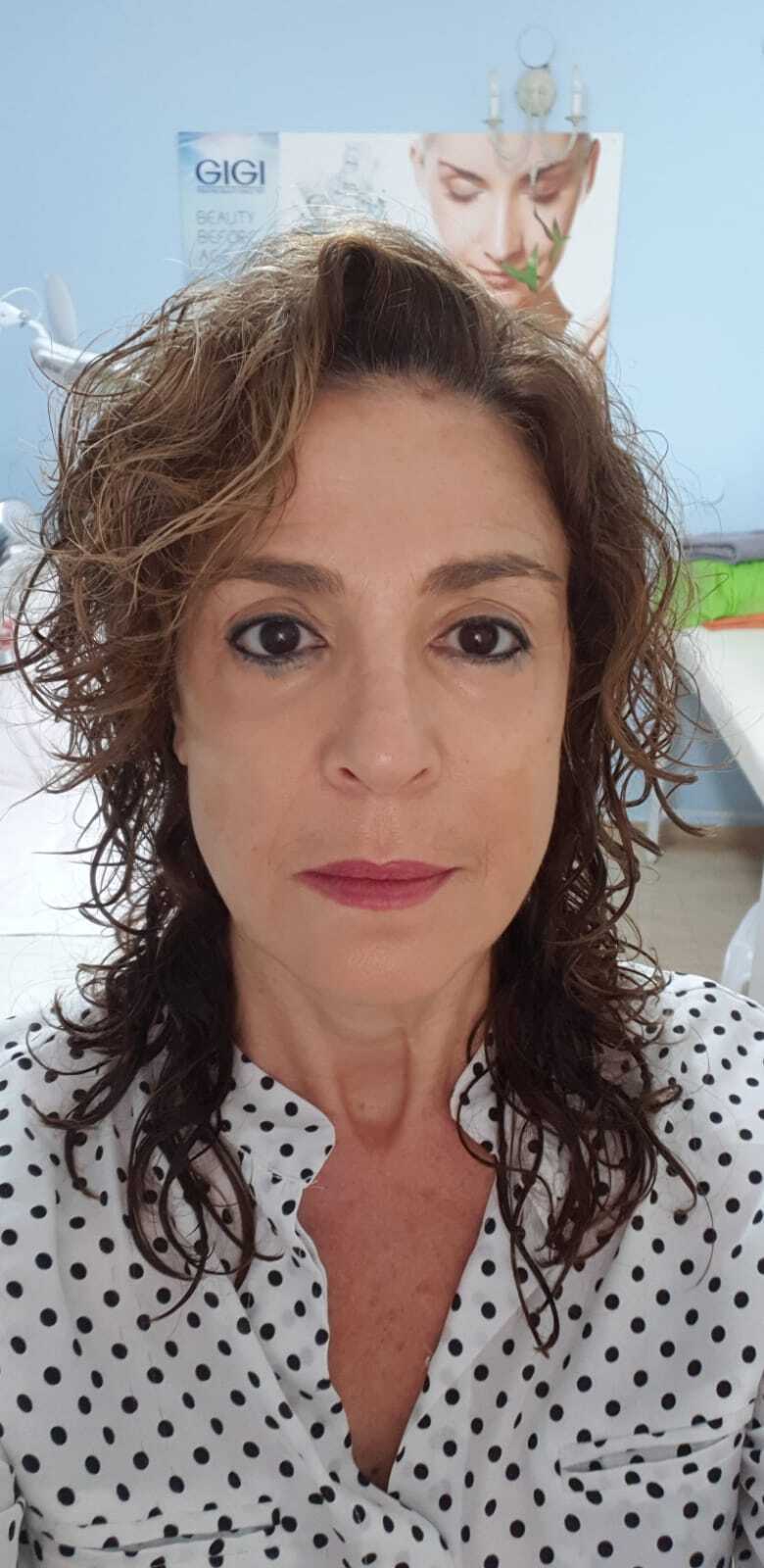 הסרת שיער - דינה גבאי