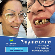 מחלות חניכיים: כל מה שצריך לדעת