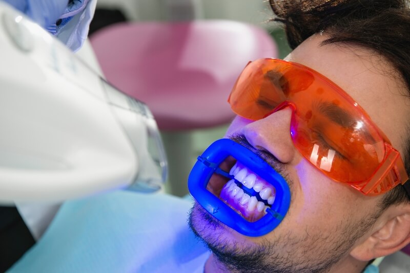 טיפול להלבנת שיניים בלייזר