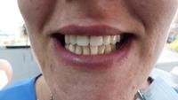 User upload